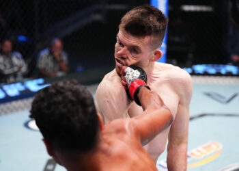 Hardwick Shows Off Wired Jaw After Brutal Loss: ‘It’s Pretty F—king Dire’