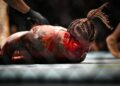 One fighter transported to hospital following bloody UFC Paris beating